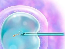 镇江三代试管婴儿寻找更好的私立医院