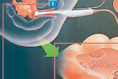 2026年的佛山三代试管婴儿私立医院有哪些？