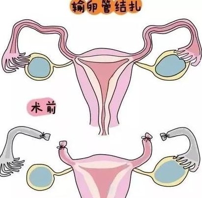 泰国试管医院如何选择？有知道的吗？